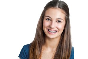 Teen wearing traditional braces