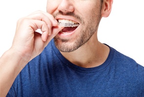 man inserting Invisalign